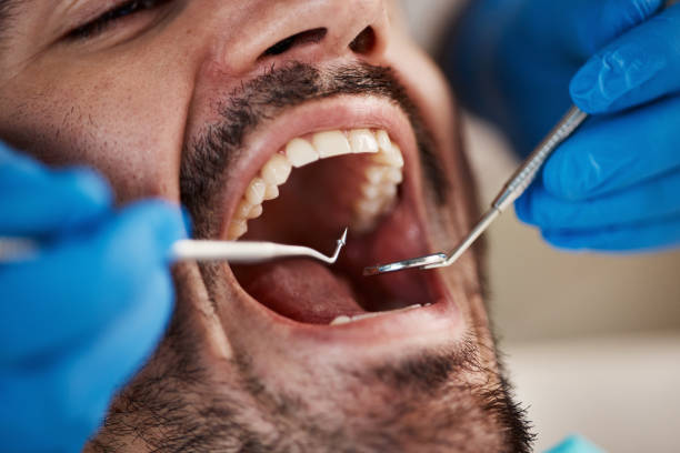 Best Weekend Emergency Dentist in Mount Vernon, IA