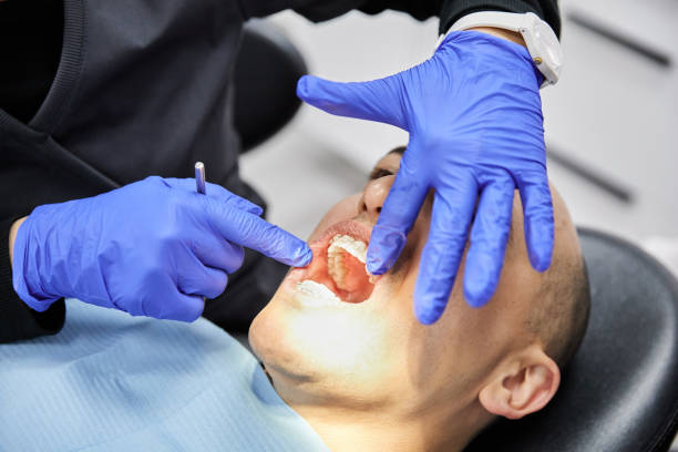 Best Emergency Treatment for Dental Infections or Abscesses in Mount Vernon, IA